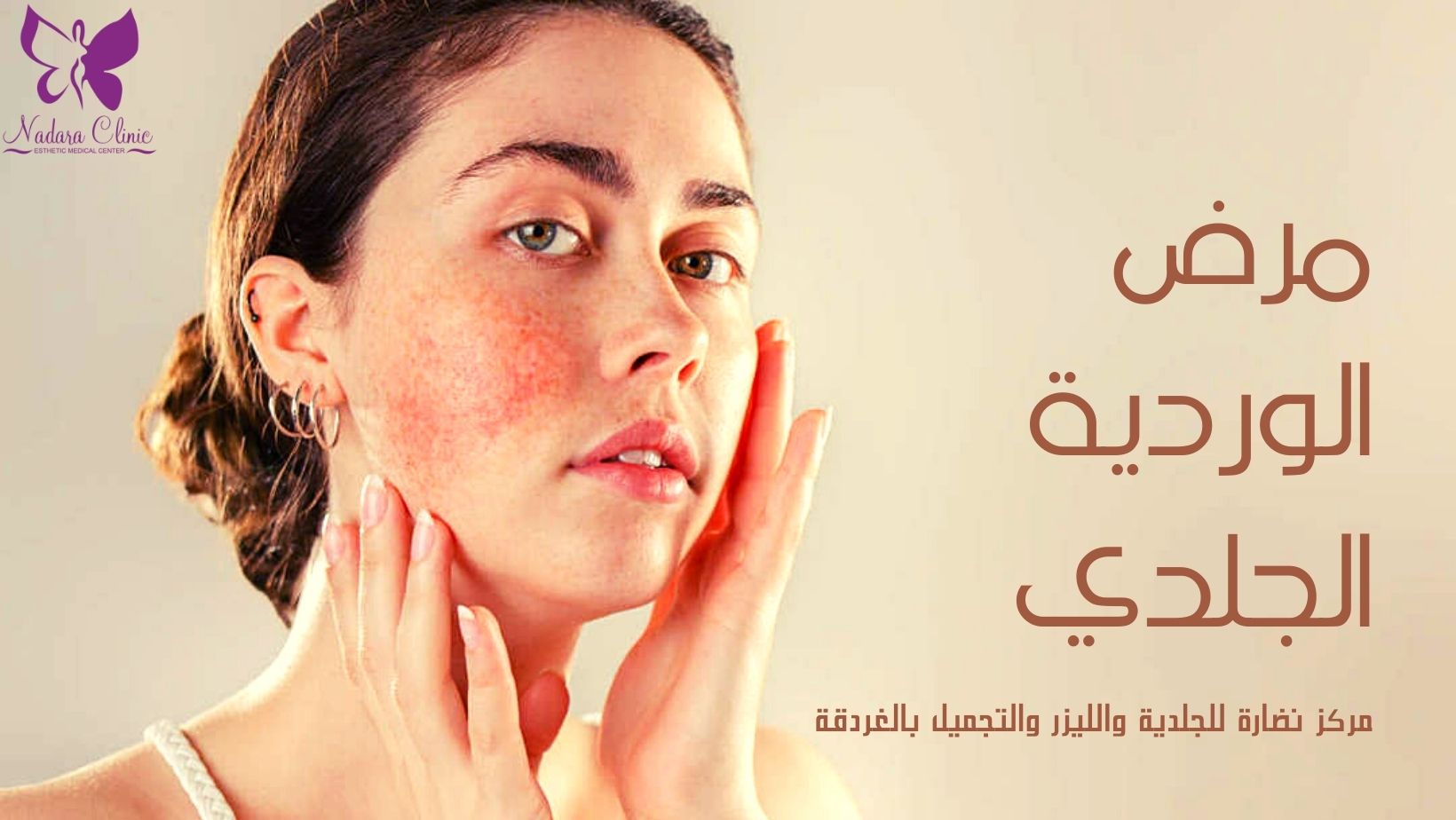 مرض الوردية الجلدي